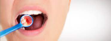 Gum Tissue: A Look Into Overall Health