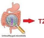 Diabetes in the Gut