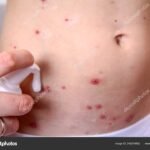 health, fitness, nutrition, wellness