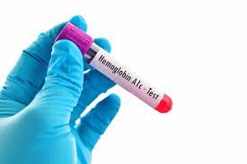 HbA1c Self-testing Deemed Feasible for Black Adults with Type 2 Diabetes