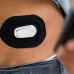 CGM Use Lowers Hospitalizations, May Reduce Mortality in Type 1 and Type 2 Diabetes
