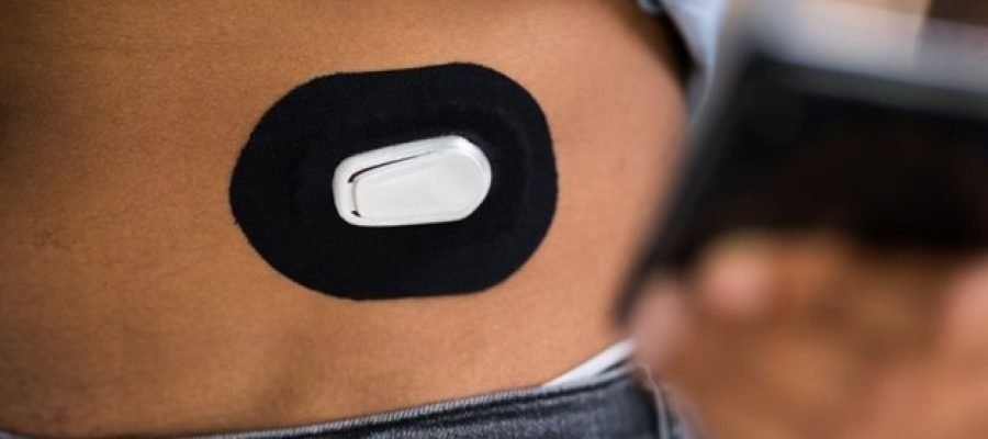 CGM Use Lowers Hospitalizations, May Reduce Mortality in Type 1 and Type 2 Diabetes