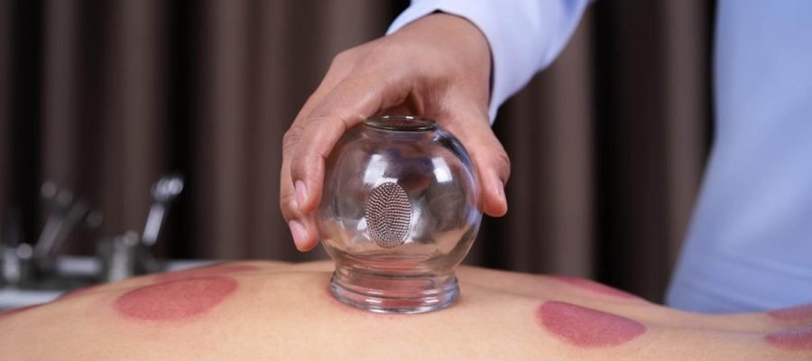 a person performing cupping on a client