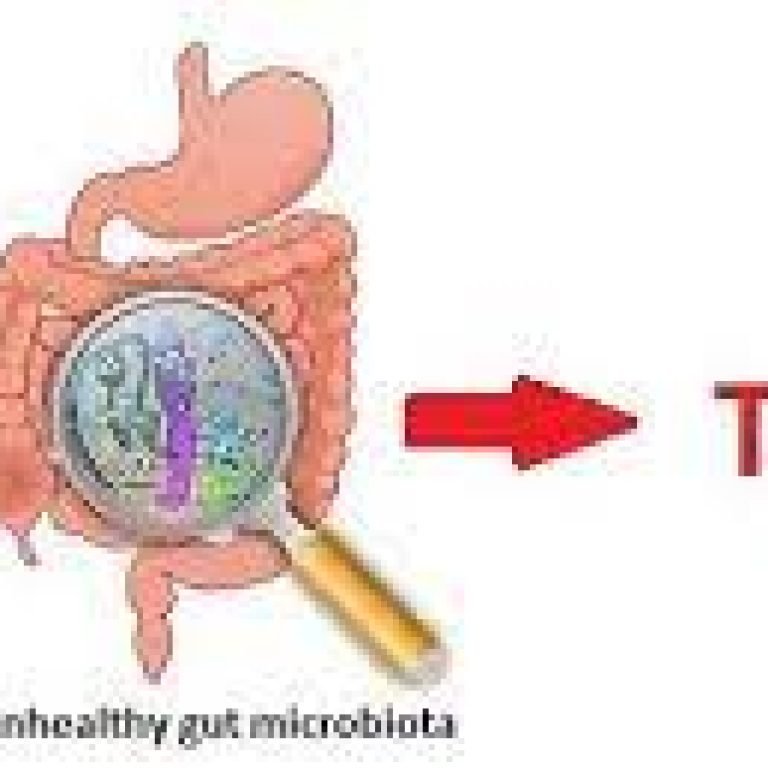 Diabetes in the Gut