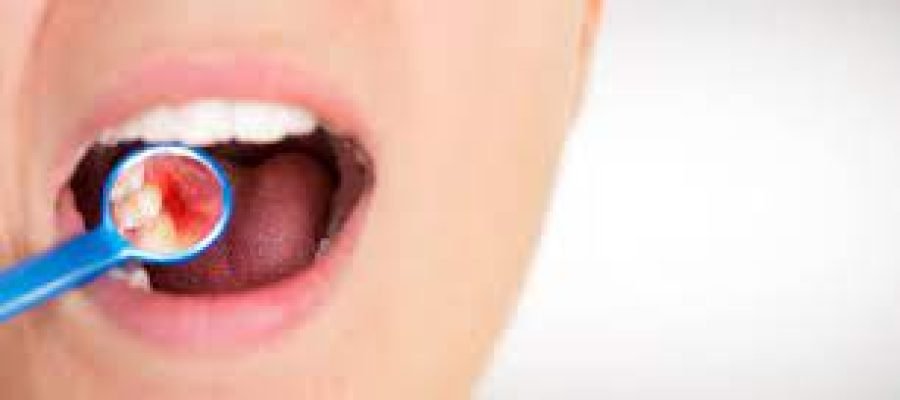 Gum Tissue: A Look Into Overall Health