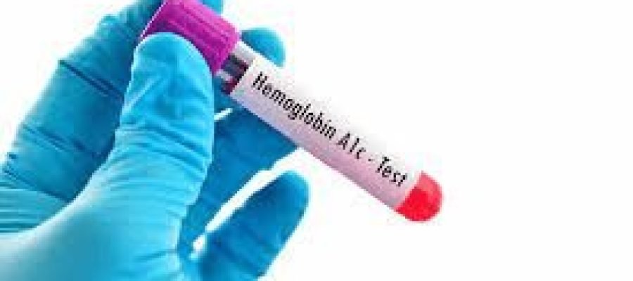 HbA1c Self-testing Deemed Feasible for Black Adults with Type 2 Diabetes