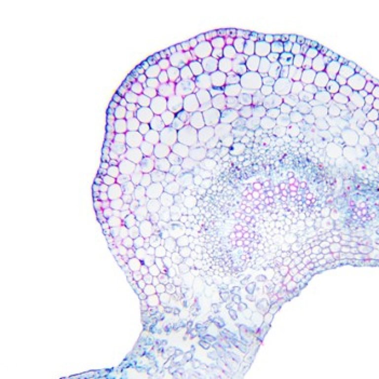 What Are Digestive Enzymes